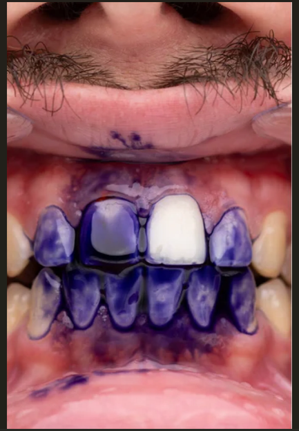 Pasta Dental Obsessive™